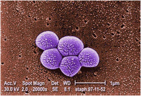 http://img.webmd.com/dtmcms/live/webmd/consumer_assets/site_images/articles/health_tools/MRSA_Slideshow_slide_1.jpg